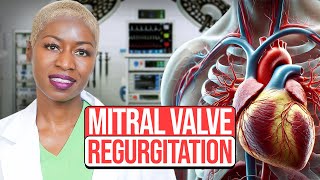 Mitral Regurgitation causes pulmonary edema [upl. by Idolla]