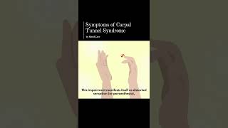 Symptoms of Carpal Tunnel Syndrome [upl. by Eilyr]