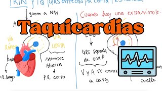 FISIOPATOLOGÍA de las ARRITMIAS con sus TRATAMIENTOS [upl. by Naivaj877]