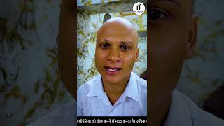 alopecia areata natural treatment How to prevent PATCHY HAIR LOSS  Dr Bansal  ganjapan [upl. by Sugirdor648]