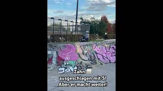 Zahn🦷ausgeschlagen Er macht trotzdem weiter scooter skaters skatepark bunnyhop [upl. by Volpe852]