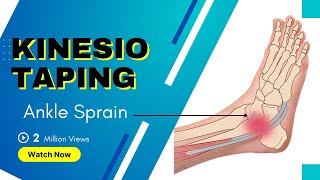 How to treat an Ankle Inversion Sprain  Kinesiology Taping to stabilise ligaments [upl. by Quinby]