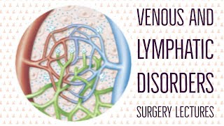 VENOUS DISORDERS lecture 1 VARICOSE VEINS description of venous system of lower limb in easy way [upl. by Abner]