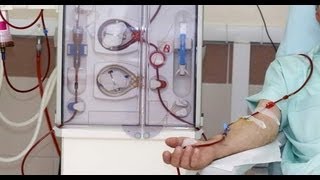 Kidney dialysis All you need to know Dr Deepa Jayaram [upl. by Arnie]