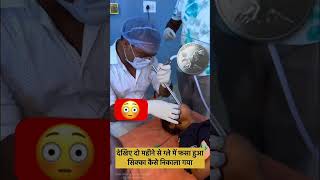 Do ka sikha kaise nikale gale se shortsfeed nursingstudentlife  ytshortsyoutubeshorts [upl. by Furtek]