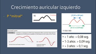 Crecimientos auriculares en el electrocardiograma  Onda P quotPulmonarquot  Onda P quotMitralquot [upl. by Akila]