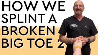 How to Splint a Broken Big Toe 2 [upl. by Tania]