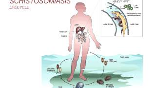 Webinar Schistosomiasis  Diagnosis and Treatment 2014 [upl. by Izawa]