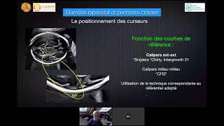 BIOMÉTRIE FOETALE BIEN MESURER  ÉCHOGRAPHIE OBSTÉTRICALE [upl. by Ecnarolf]