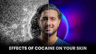 The Shocking Effects Of COCAINE On Your SKIN And The AGEING Process [upl. by Oluap146]