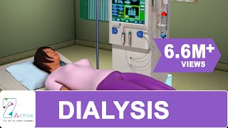 Procedure of DIALYSIS [upl. by Elspet]