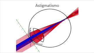 Astigmatismo parte 1 clasificación monocular introducción conoide de Sturm Paradoja astigmática [upl. by Sutsuj]