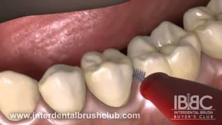 HOW TO USE AN INTERDENTAL BRUSH [upl. by Bertolde301]