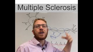 Multiple Sclerosis [upl. by Eslud]