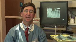 Tooth Abscess  Wisdom Tooth Abscess Symptoms [upl. by Sally]