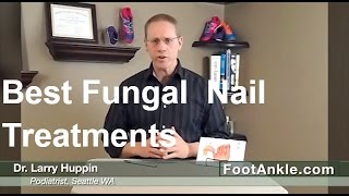 What are the Best Treatments for Fungal Toenails  Seattle Podiatrist Larry Huppin [upl. by Llenrap]