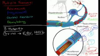 Pathophysiology of multiple sclerosis [upl. by Lunneta]