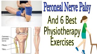 6 Best Common Peroneal Nerve Palsy And Physiotherapy Treatment geethamihi [upl. by Ayikur]