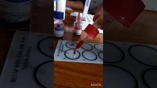 WIDAL TEST PROCEDURE FOR TYPHOID [upl. by Nananne658]