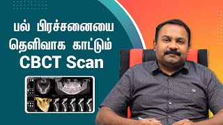 CBCT Dental Scan Full Mouth Scan  சிபிசிடி டென்டல் ஸ்கேன் பயன் என்ன  Samayam Tamil [upl. by Notsnarc]