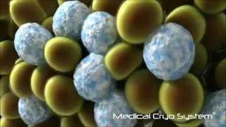 Medical Cryo System  Les effets de la cryolipolyse sur la masse graisseuse [upl. by Yddet]