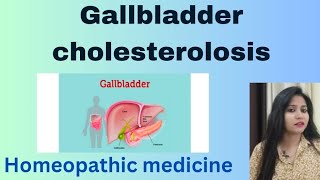 Gallbladder cholesterolosis treatment  Cholesterolosis symptomscauses amp Homeopathic medicine [upl. by An]