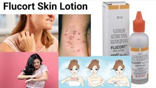 flucort skin lotion uses in hindi  Fluocinolone 001  wv lotion benefits uses side effects [upl. by Neel]