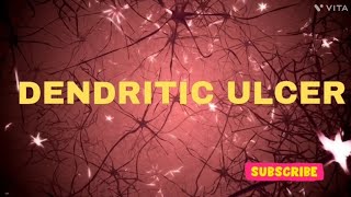 Dendritic ulcer  ULCER  OPHTHALMOLOGY USMLE  NEETPG  INICET  NEETPG MBBS SCIENCEPARADISE [upl. by Nivlad]