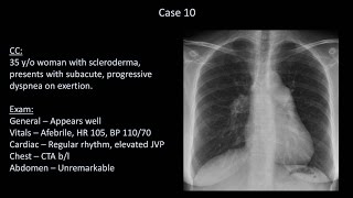 How to Interpret a Chest XRay Lesson 10  Self Assessment Part 2 [upl. by Amora]