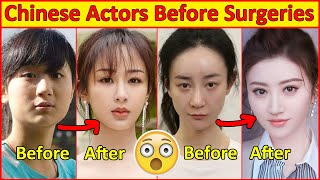 Chinese Actors Before and After Plastic Surgeries 😮  Incredible Changes Chinese Drama [upl. by Swenson]