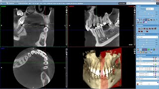 Five ways to manipulate a 3D volume [upl. by Esteban126]