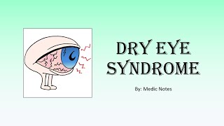 Dry eye syndrome  causes investigation treatment [upl. by Weibel94]