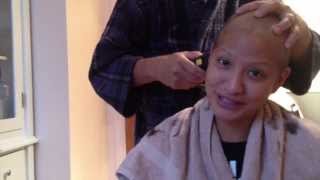 Losing Hair  Breast Cancer patient loses hair from chemotherapy [upl. by Cornish]