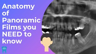 Anatomy of Panoramic Films  Learn how to interpret OPTs [upl. by Esinereb]