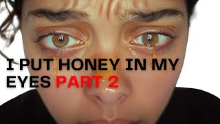 Jimerito Stingless Bee Honey Eye Drop Review stinglessbees jimeritohoney jimerito [upl. by Surbeck]