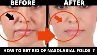 14 MIN  ANTIAGING EXERCISES FOR NASOLABIAL FOLDS REMOVE WRINKLES ON THE FACE  TURKEY NECK [upl. by Potts609]