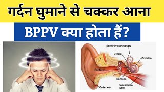 BPPV क्या हैं causes symptoms amp treatment in Hindi  Benign paroxysmal positional vertigo [upl. by Laehcim]