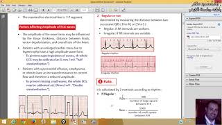 6 SYSTEMATIC INTERPRETATION GUIDELINES OF ECGStandardizationRateRhythmAxis ProfDrmahmoud Allam [upl. by Schroer]