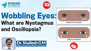 Why Do My Eyes Keep Moving Nystagmus and Oscillopsia Explained  Shekar Eye Hospital [upl. by Joan]