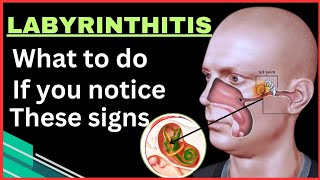 What is Labyrinthitis  Unraveling Causes Symptoms  Inner Ear Wellness happyhealingaz [upl. by Ardekan]