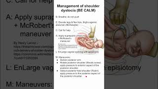 Management of shoulder dystocia BE CALM [upl. by Yrruc]