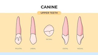 Cutting Maxillary Canine with KH Tanta 🔥 [upl. by Pohsib841]