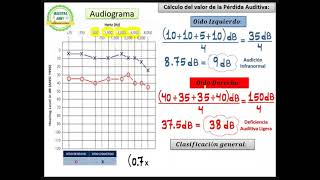 AUDIOGRAMA Y CÁLCULO DE PÉRDIDA AUDITIVA [upl. by Bertasi]