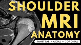 Shoulder MRI Anatomy  Radiology anatomy part 1 prep  How to interpret a shoulder MRI [upl. by Aihsekan]