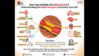 World Thrombosis Day Thrombosis Awareness Blood Clots DVT Prevention Vascular Health Blood Cl [upl. by Bonne316]