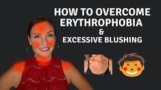 How To Cure Erythrophobia amp Excessive Blushing [upl. by Aziza]