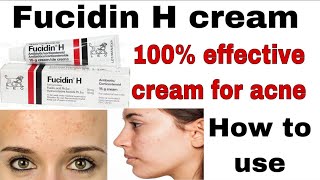 how to use fucidin H cream  for the acne treatment  complete review in urdu [upl. by Meehyr]