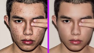 Fastest way to clean your face in photoshop  Remove pimples blemishes acne easily [upl. by Lunt]