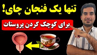 تنها یک قدم تا درمان بیماری پروستات [upl. by Auqenet]