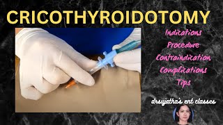 205cricothyroidotomy cricothyrotomy procedure airway emergency stridor [upl. by Edras]